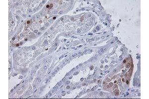 Immunohistochemical staining of paraffin-embedded Human Kidney tissue using anti-PGAM2 mouse monoclonal antibody.