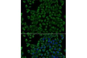 Immunofluorescence analysis of U2OS cells using TCN2 Polyclonal Antibody (TCN2 anticorps)