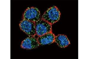 Confocal immunofluorescent analysis of Estrogen Receptor antibody with ZR-75-1 cells followed by Alexa Fluor 488-conjugated goat anti-rabbit lgG (green). (Estrogen Receptor alpha anticorps  (AA 246-273))