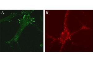 A: Indirect immunolabeling of NHF cells (dilution 1 : 100).