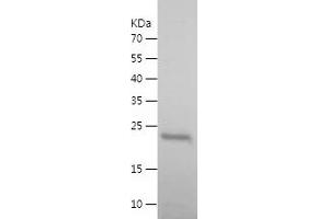 Western Blotting (WB) image for Interleukin 6 (IL6) (AA 29-212) (Active) protein (His tag) (ABIN7123608)