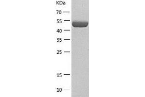 Western Blotting (WB) image for CNDP Dipeptidase 2 (Metallopeptidase M20 Family) (CNDP2) (AA 1-475) protein (His-IF2DI Tag) (ABIN7122413)