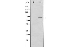 Western blot analysis of PAK1 phosphorylation expression in etoposide treated 293 whole cell lysates,The lane on the left is treated with the antigen-specific peptide. (PAK1 anticorps  (pThr212))