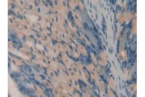 Detection of OCM in Mouse Stomach Tissue using Polyclonal Antibody to Oncomodulin (OCM) (Oncomodulin anticorps  (AA 1-109))
