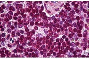 Human Spleen: Formalin-Fixed, Paraffin-Embedded (FFPE) (SOX10 anticorps)