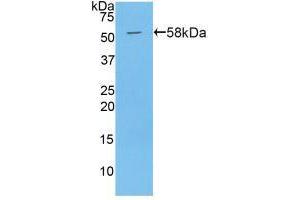 Western blot analysis of recombinant Mouse PAPPA. (PAPPA anticorps  (AA 999-1272))