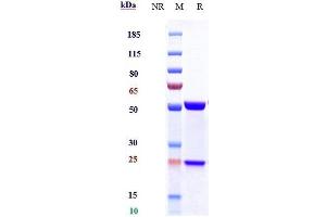 Anti-IL-6 / IFNb2 Reference Antibody (siltuximab) on SDS-PAGE under reducing (R) condition. (Recombinant IL6 (Siltuximab Biosimilar) anticorps)