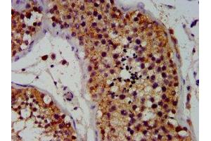 IHC image of ABIN7164068 diluted at 1:100 and staining in paraffin-embedded humantestis tissue performed on a Leica BondTM system.