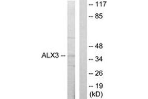 Western blot analysis of extracts from 293 cells, using ALX3 Antibody.