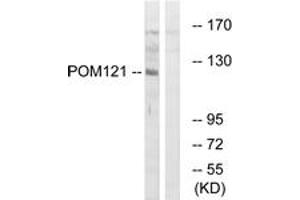 Western blot analysis of extracts from K562 cells, using POM121 Antibody. (POM121 anticorps  (AA 1197-1246))