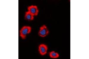 Immunofluorescent analysis of MUC1 staining in HeLa cells.