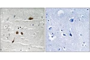 Immunohistochemistry analysis of paraffin-embedded human brain, using MDC1 (Phospho-Ser513) Antibody. (MDC1 anticorps  (pSer513))
