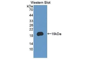 Detection of Recombinant PCDH20, Human using Polyclonal Antibody to Protocadherin 20 (PCDH20) (PCDH20 anticorps  (AA 64-209))