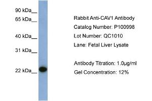 WB Suggested Anti-CAV1  Antibody Titration: 0.