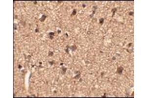 Immunohistochemistry of Slitrk1 in human brain tissue with this product at 2. (SLITRK1 anticorps  (Middle Region))