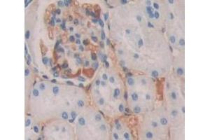 Used in DAB staining on fromalin fixed paraffin- embedded kidney tissue (Uroplakin 3A anticorps  (AA 15-212))