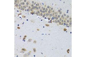 Immunohistochemistry of paraffin-embedded mouse brain using CIRBP antibody.