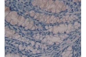 Detection of HDC in Mouse Colon Tissue using Polyclonal Antibody to Histidine Decarboxylase (HDC) (HDC anticorps  (AA 341-597))