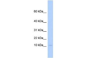 WB Suggested Anti-PLAC9 Antibody Titration:  0. (PLAC9 anticorps  (Middle Region))