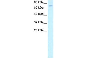 WB Suggested Anti-ZFP95 Antibody Titration: 1. (ZKSCAN5 anticorps  (N-Term))