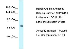 Western Blotting (WB) image for anti-Moesin (MSN) (C-Term) antibody (ABIN971193) (Moesin anticorps  (C-Term))