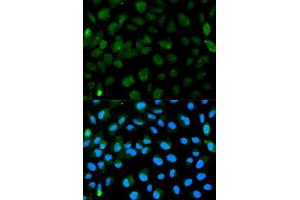 Immunofluorescence analysis of HeLa cell using PML antibody. (PML anticorps  (AA 300-600))