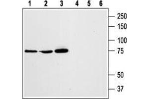 Western blot analysis of rat RBL basophilic leukemia (lanes 1 and 4), human HL-60 promyelocytic leukemia (lanes 2 and 5), and human Jurkat T-cell leukemia (lanes 3 and 6) cell lysates: - 1,2,3. (STIM1 anticorps  (Extracellular, N-Term))
