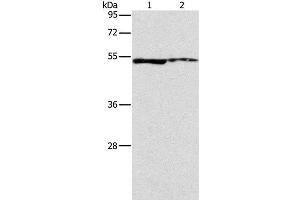 Western Blot analysis of A549 and Mouse eye tissue using ALDH3A1 Polyclonal Antibody at dilution of 1:750