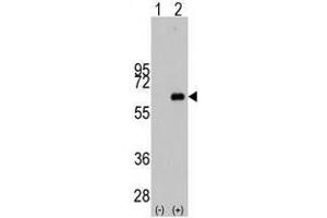 Image no. 1 for anti-Myc Proto-Oncogene protein (MYC) antibody (ABIN357362) (c-MYC anticorps)
