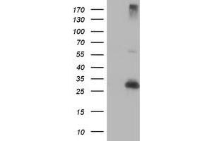 Western Blotting (WB) image for anti-Regulatory Factor X-Associated Ankyrin Containing Protein (RFXANK) antibody (ABIN1500679) (RFXANK anticorps)