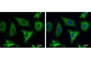 ICC/IF Image Fatty Acid Synthase antibody [N1N2], N-term detects Fatty Acid Synthase protein at cytoplasm by immunofluorescent analysis. (Fatty Acid Synthase anticorps  (N-Term))