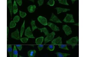 Immunofluorescence analysis of L929 cells using FKBP1B Polyclonal Antibody at dilution of 1:100 (40x lens).