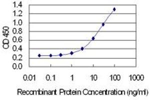 Detection limit for recombinant GST tagged XPA is 0. (XPA anticorps  (AA 1-273))