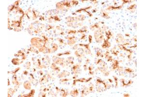 Formalin-fixed, paraffin-embedded human Pancreas stained with CFTR Rabbit Recombinant Monoclonal Antibody (CFTR/2290R).