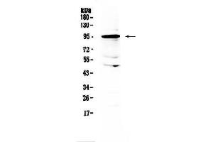 Western blot analysis of AMOTL2 using anti-AMOTL2 antibody .