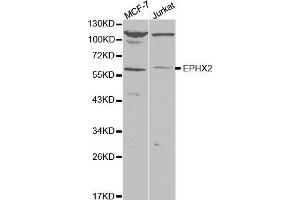 Western blot analysis of extracts of various cell lines, using EPXH2 antibody. (EPHX2 anticorps)