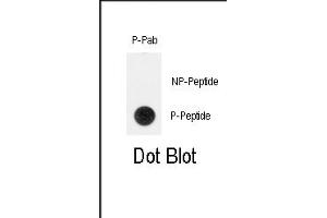 Dot blot analysis of anti-Phospho-TERT-p Antibody (ABIN390002 and ABIN2839778) on nitrocellulose membrane. (TERT anticorps  (pTyr707))