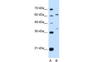 WB Suggested Anti-IL28RA Antibody Titration:  0. (IL28RA anticorps  (N-Term))