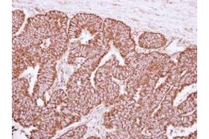 anti-Peptidylprolyl Isomerase F (PPIF) (AA 21-207) antibody