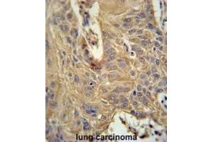 Immunohistochemistry (IHC) image for anti-Interleukin 5 Receptor, alpha (IL5RA) antibody (ABIN3002275) (IL5RA anticorps)