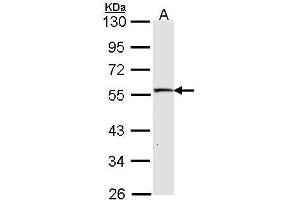 WB Image Sample (30 ug of whole cell lysate) A: IMR32 10% SDS PAGE antibody diluted at 1:1000 (STK26/MST4 anticorps  (C-Term))