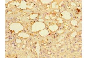 Immunohistochemistry of paraffin-embedded human adrenal gland tissue using ABIN7142262 at dilution of 1:100 (MRPS28 anticorps  (AA 72-187))