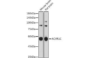 Western blot analysis of extracts of various cell lines, using C antibody (ABIN3021053, ABIN3021054, ABIN3021055 and ABIN6213930) at 1:1000 dilution. (ACVR1C/ALK7 anticorps  (AA 22-113))