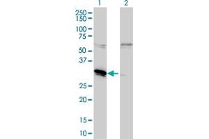 Western Blot analysis of MLF2 expression in transfected 293T cell line by MLF2 monoclonal antibody (M01), clone 2F6-1E3. (MLF2 anticorps  (AA 1-248))