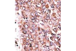 Image no. 1 for anti-Wnt1 Inducible Signaling Pathway Protein 3 (WISP3) (Middle Region) antibody (ABIN358747)