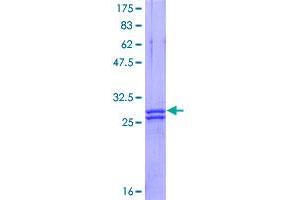 Image no. 1 for Proteolipid Protein 1 (PLP1) (AA 177-232) protein (GST tag) (ABIN1315455)