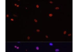 Immunofluorescence analysis of C6 cells using HDGF Polyclonal Antibody at dilution of 1:100. (HDGF anticorps)