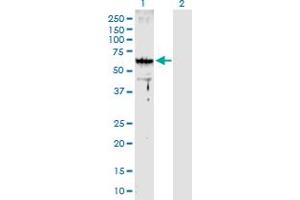 Western Blot analysis of ARMC8 expression in transfected 293T cell line by ARMC8 MaxPab polyclonal antibody. (ARMC8 anticorps  (AA 1-385))