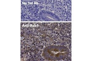 Immunohistochemistry (IHC) image for anti-RAB1A, Member RAS Oncogene Family (RAB1A) (C-Term) antibody (ABIN1440053)