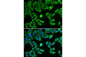 Immunofluorescence analysis of HeLa cells using SH2B1 antibody. (SH2B1 anticorps)